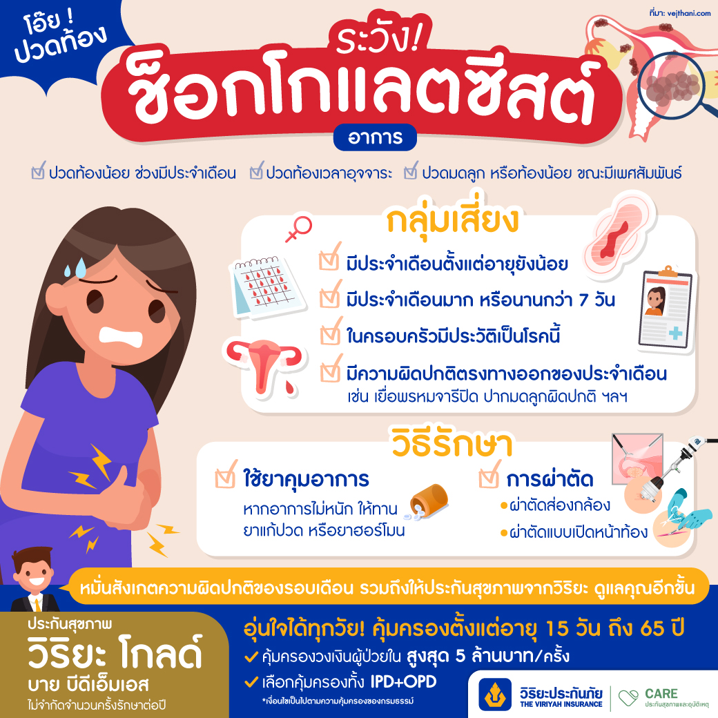 ปวดท้องเป็นช็อกโกแลตซีสต์