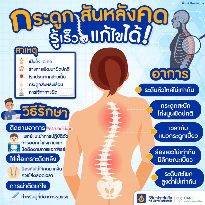 scoliosis
