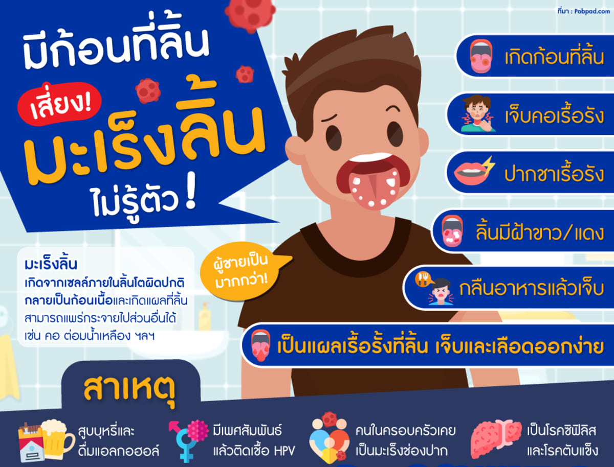 ก้อนที่ลิ้น มะเร็งลิ้น มะเร็งช่องปาก ประกันมะเร็งวิริยะ