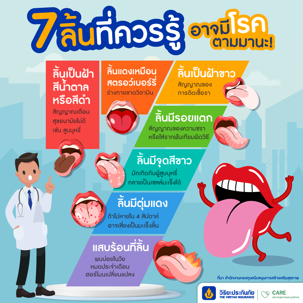 7 สัญญาณเตือน ลิ้นบอกโรค