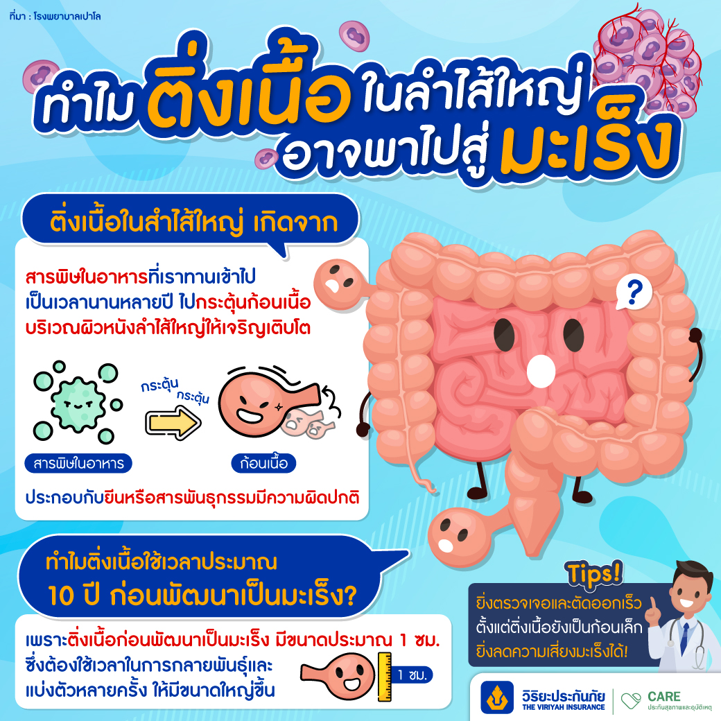 ติ่งเนื้องอกในลำไส้ใหญ่ มะเร็งลำไส้ใหญ่ วิริยะประกันมะเร็ง
