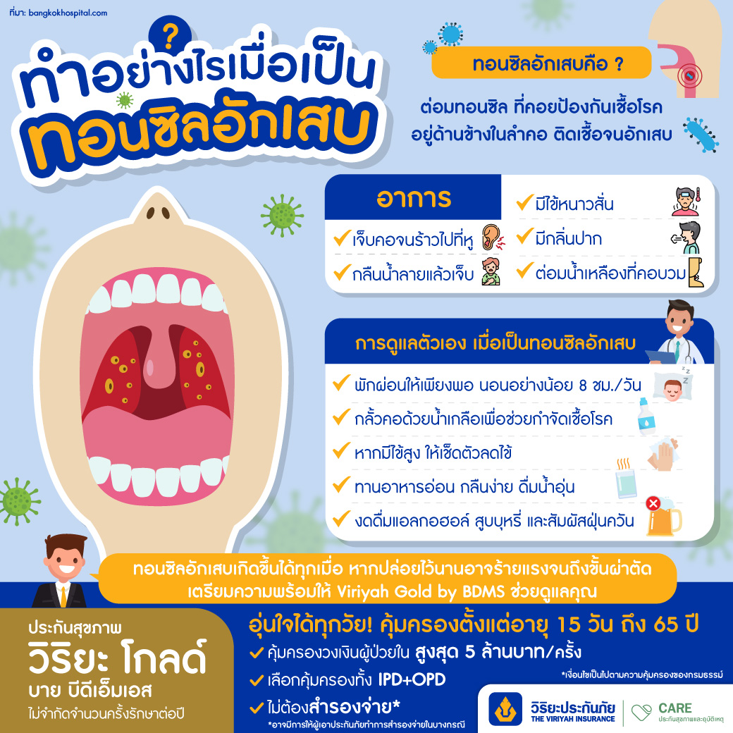 tonsillitis